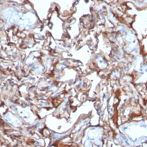 MCAM (Melanoma Cell Adhesion Molecule) / MUC18 / CD146; Clone MCAM/1101 (Concentrate)